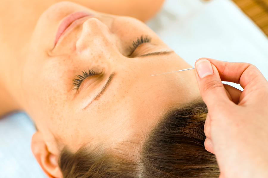 craniopuncture-toulouse